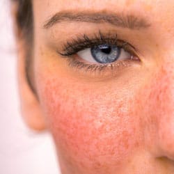 DRHAZI Treatment Complex®