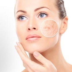 Pigmentfolthalványító peptid